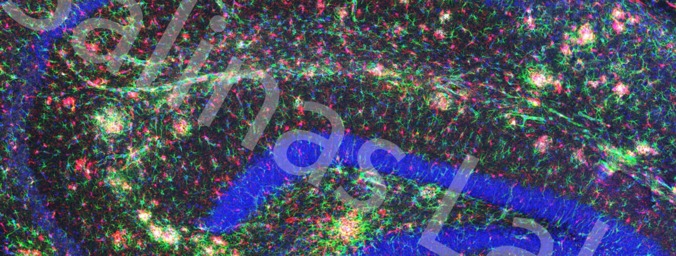 TileScan Hippocampus NLGF with watermark copy